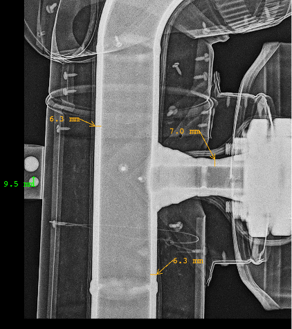 Digital radiography of a lagged pipe for wall thickness